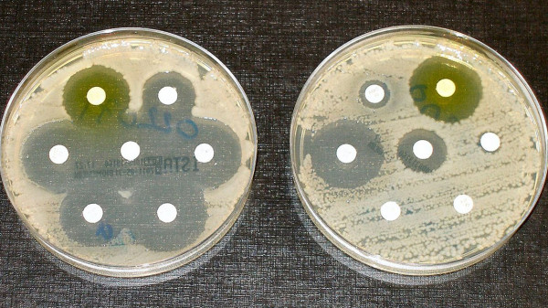 في تجربه لدراسه اثر انواع مختلفه من المضادات الحيويه على نمو البكتيريا يكون العامل التابع هو